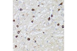 Immunohistochemistry of paraffin-embedded rat brain using MIP antibody at dilution of 1:100 (x40 lens). (MIP antibody)