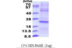 SDS-PAGE (SDS) image for Dual Specificity Phosphatase 22 (DUSP22) (AA 1-184) protein (His tag) (ABIN5853708)