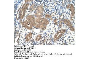 Rabbit Anti-ACP1 Antibody  Paraffin Embedded Tissue: Human Kidney Cellular Data: Epithelial cells of renal tubule Antibody Concentration: 4. (ACP1 antibody  (N-Term))