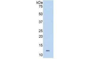 Western Blotting (WB) image for Platelet/endothelial Cell Adhesion Molecule (PECAM1) ELISA Kit (ABIN6730949)