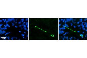 Rabbit Anti-MTUS1 Antibody     Formalin Fixed Paraffin Embedded Tissue: Human Pineal Tissue  Observed Staining: Cytoplasmic and membrane in cell bodies of pinealocytes and their processes  Primary Antibody Concentration: 1:100  Other Working Concentrations: 1/600  Secondary Antibody: Donkey anti-Rabbit-Cy3  Secondary Antibody Concentration: 1:200  Magnification: 20X  Exposure Time: 0. (MTUS1 antibody  (Middle Region))