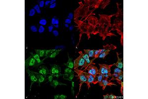 Immunocytochemistry/Immunofluorescence analysis using Mouse Anti-GABA-A Receptor Alpha2 Monoclonal Antibody, Clone S399-19 . (GABRA1 antibody  (AA 350-385) (FITC))