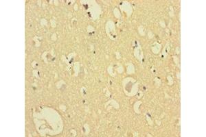 Immunohistochemistry of paraffin-embedded human brain tissue using ABIN7148784 at dilution of 1:100