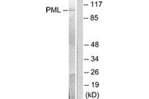 Western blot analysis of extracts from A549 cells, using PML Antibody. (PML antibody  (AA 11-60))