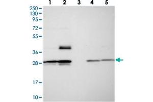 Western blot analysis of Lane 1: RT-4, Lane 2: U-251 MG, Lane 3: Human Plasma, Lane 4: Liver, Lane 5: Tonsil with MXRA7 polyclonal antibody  at 1:250-1:500 dilution.