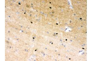Anti- PARP Picoband antibody, IHC(P) IHC(P): Rat Brain Tissue (PARP1 antibody  (AA 670-858))
