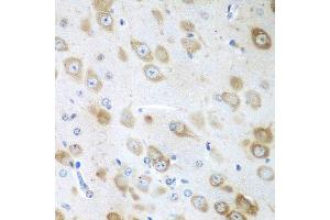 Immunohistochemistry of paraffin-embedded mouse brain using GFM1 antibody at dilution of 1:100 (40x lens). (GFM1 antibody)