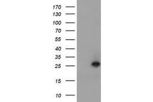 Image no. 1 for anti-Ubiquitin-Conjugating Enzyme E2E 3 (UBE2E3) antibody (ABIN1501619) (UBE2E3 antibody)