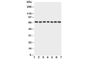 Western blot testing of NOX4 antibody and Lane 1:  rat kidney (NADPH Oxidase 4 antibody  (C-Term))