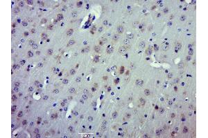 Paraformaldehyde-fixed, paraffin embedded mouse brai; Antigen retrieval by boiling in sodium citrate buffer (pH6. (DPYSL2 antibody  (AA 1-100))