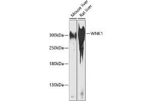 Western blot analysis of extracts of various cell lines, using WNK1 antibody  at 1:1000 dilution. (WNK1 antibody  (AA 1-210))