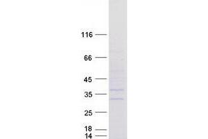 Western Blotting (WB) image for Abhydrolase Domain Containing 14A (ABHD14A) protein (Myc-DYKDDDDK Tag) (ABIN2714273)