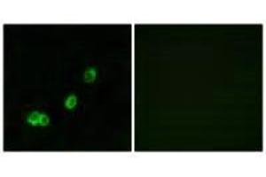 Immunofluorescence analysis of MCF-7 cells, using ACOT1 antibody.