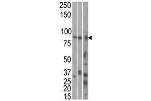 The MARK1 antibody used in western blot to detect MARK1 in HeLa, T47D, and mouse brain cell line/ tissue lysate (left to right) (MARK1 antibody  (AA 671-700))