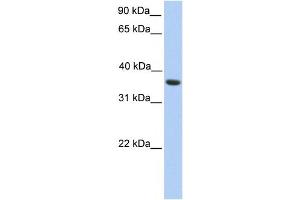 Western Blotting (WB) image for anti-Melanoma Antigen Family A, 4 (MAGEA4) antibody (ABIN2459747) (MAGEA4 antibody)