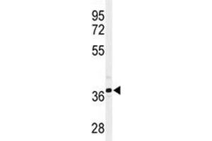 Western blot analysis of SIRT3 antibody and CHO lysate (SIRT3 antibody  (AA 304-334))