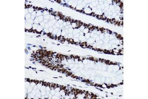 Immunohistochemistry of paraffin-embedded human colon using Acetyl-Histone H3-K9 antibody (ABIN7267675) at dilution of 1:200 (40x lens). (Histone 3 antibody  (H3K9))