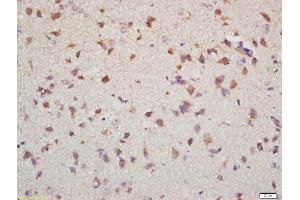 Formalin-fixed and paraffin embedded mouse brain labeled with Anti-NET1 Polyclonal Antibody, Unconjugated (ABIN1714215) at 1:200 followed by conjugation to the secondary antibody and DAB staining (NET1 antibody)