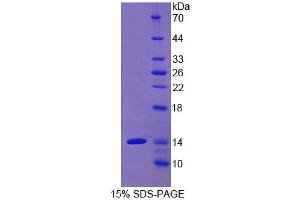 Image no. 1 for CD90 (THY1) (AA 20-133) protein (His tag) (ABIN1099503)