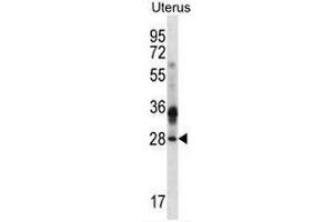 CIB4 Antibody (N-term) western blot analysis in human normal Uterus cell line lysates (35µg/lane). (CIB4 antibody  (N-Term))