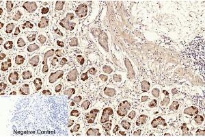 Immunohistochemical analysis of paraffin-embedded human stomach tissue. (NF-kB p65 antibody  (acLys310))