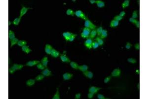 Immunofluorescence staining of SH-SY5Y cells with ABIN7169246 at 1:200, counter-stained with DAPI. (PPP2R2B antibody  (Regulatory Subunit B))