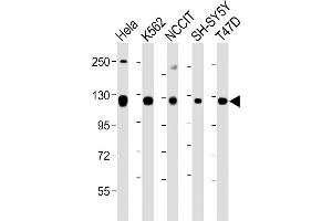All lanes : Anti-ROR2 Antibody (C-term) at 1:1000-1:2000 dilution Lane 1: Hela whole cell lysate Lane 2: K562 whole cell lysate Lane 3: NCCIT whole cell lysate Lane 4: SH-SY5Y whole cell lysate Lane 5: T47D whole cell lysate Lysates/proteins at 20 μg per lane.
