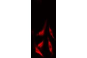 ABIN6277509 staining  LOVO cells by IF/ICC. (Cullin 2 antibody  (C-Term))