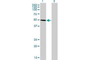 Western Blot analysis of ZNF277 expression in transfected 293T cell line by ZNF277 monoclonal antibody (M01), clone 1B2. (ZNF277 antibody  (AA 1-278))