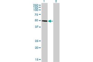 Western Blot analysis of ZNF277 expression in transfected 293T cell line by ZNF277 monoclonal antibody (M01), clone 1B2.