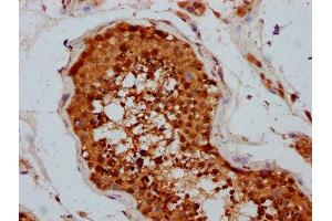 IHC image of ABIN7173536 diluted at 1:400 and staining in paraffin-embedded human testis tissue performed on a Leica BondTM system. (TSEN15 antibody  (AA 1-171))