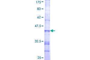 ST3GAL6 Protein (AA 145-240) (GST tag)