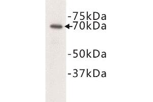 Western Blotting (WB) image for anti-Complement C3 beta Chain (C3b) antibody (ABIN1854871) (Complement C3b antibody)