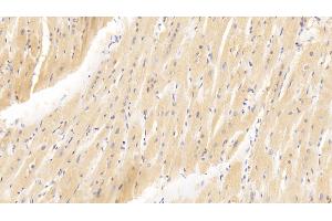 Detection of GATA4 in Human Cardiac Muscle Tissue using Polyclonal Antibody to GATA Binding Protein 4 (GATA4) (GATA4 antibody  (AA 201-442))