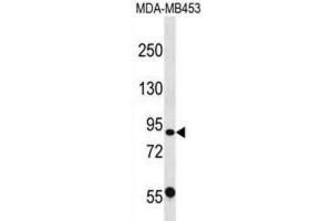 Western Blotting (WB) image for anti-Calpain 13 (CAPN13) antibody (ABIN2998758) (CAPN13 antibody)