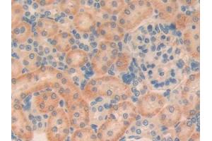DAB staining on IHC-P; Samples: Rat Kidney Tissue (TGFB1I1 antibody  (AA 256-461))
