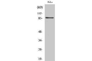 Western Blotting (WB) image for anti-UTP14, U3 Small Nucleolar Ribonucleoprotein, Homolog A (UTP14A) (Internal Region) antibody (ABIN3180379) (UTP14A antibody  (Internal Region))
