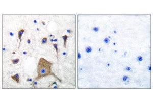 Immunohistochemistry (IHC) image for anti-Glutamate Receptor, Ionotropic, Kainate 1 (GRIK1) (N-Term) antibody (ABIN1848575) (GRIK1 antibody  (N-Term))