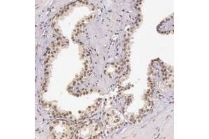 Immunohistochemical staining of human prostate with C22orf29 polyclonal antibody  shows nuclear positivity in glandular cells. (C22ORF29 antibody)