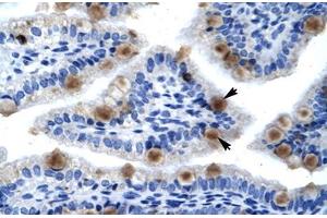 Immunohistochemical staining (Formalin-fixed paraffin-embedded sections) of human lung with MCM6 polyclonal antibody . (MCM6 antibody  (AA 771-820))