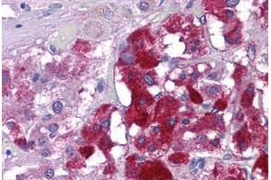 Human Adrenal: Formalin-Fixed, Paraffin-Embedded (FFPE) (KPNA3 antibody  (C-Term))