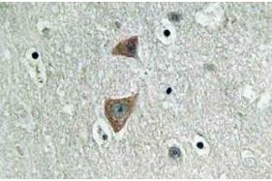 Immunohistochemistry (IHC) analyzes of p70 S6 kinase alpha antibody in paraffin-embedded human brain tissue. (RPS6KB1 antibody)