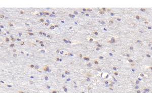 Immunohistochemistry (IHC) image for anti-Tumor Necrosis Factor Receptor Superfamily, Member 11a, NFKB Activator (TNFRSF11A) (AA 330-615) antibody (ABIN7434629)