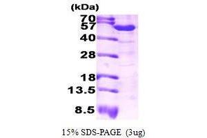 Figure annotation denotes ug of protein loaded and % gel used. (ALDH1A1 Protein (AA 1-501))