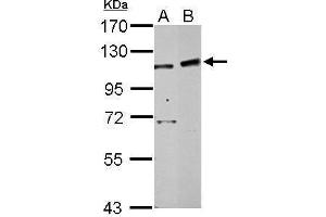 WB Image Sample (30 ug of whole cell lysate) A: 293T B: HepG2 7. (PHF16 antibody  (C-Term))