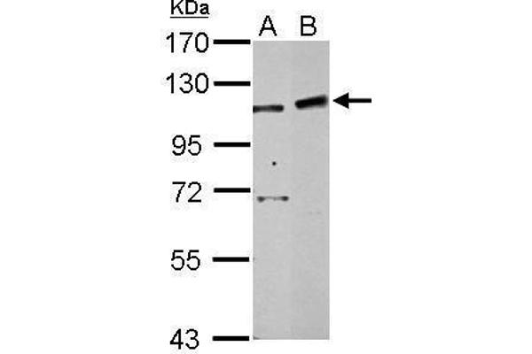 PHF16 抗体  (C-Term)