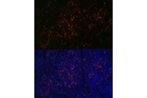 Immunofluorescence analysis of mouse spleen using BTK Rabbit mAb (ABIN7265950) at dilution of 1:100 (40x lens). (BTK antibody)