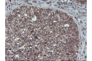 Image no. 12 for anti-Haloacid Dehalogenase-Like Hydrolase Domain Containing 1 (HDHD1) antibody (ABIN1498623)
