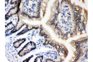 Anti- MSH2 Picoband antibody, IHC(P) IHC(P): Mouse Intestine Tissue (MSH2 antibody  (AA 337-583))