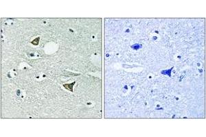 Immunohistochemistry (IHC) image for anti-Coiled-Coil Domain Containing 88A (CCDC88A) (AA 1383-1432) antibody (ABIN2889149) (Girdin antibody  (AA 1383-1432))